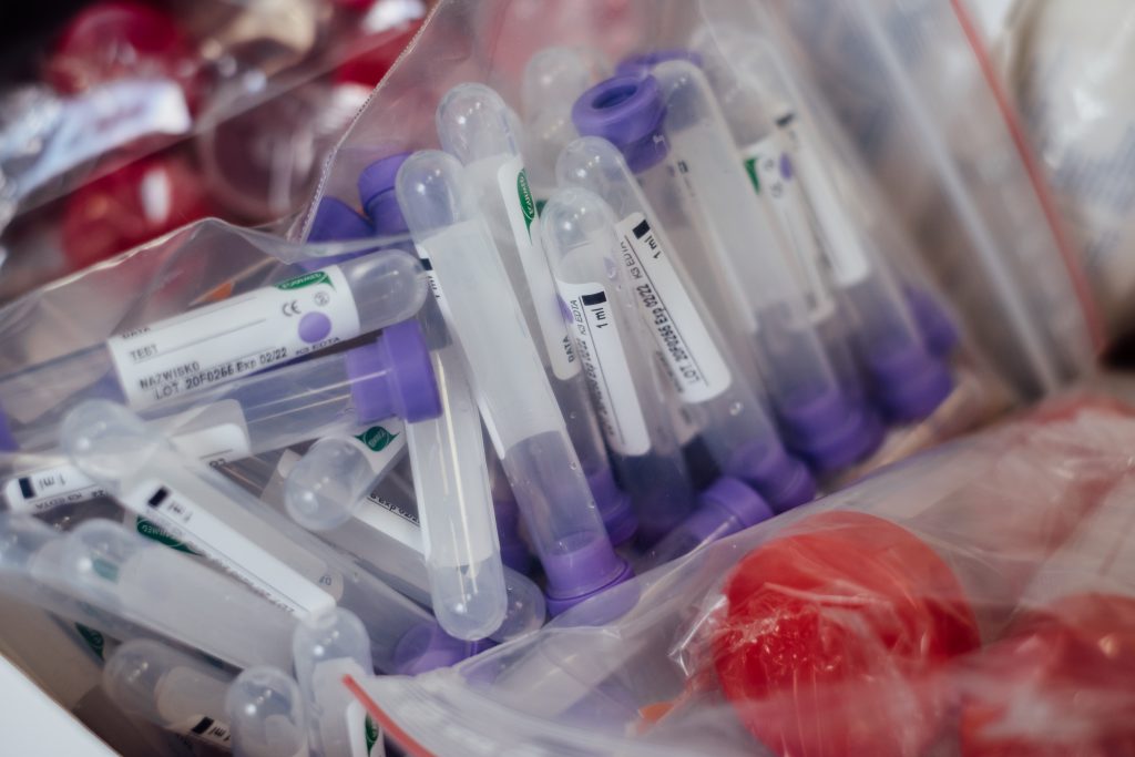 Blood sample vials - free stock photo